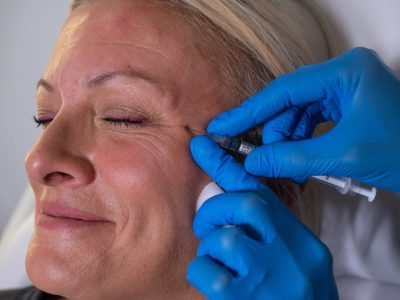 BOTOX 5